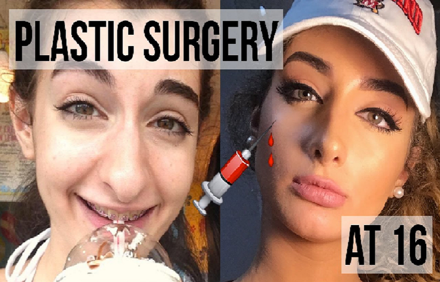 Change your life for better with plastic surgery – Ways in which it can help you