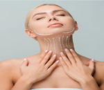 Eterna Aesthetic & Anti-Aging Clinic Bali – Thread Lifting: Visibly Lift Skin from Within